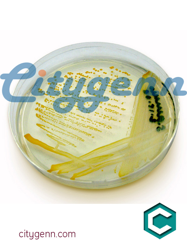 Nutrient agar 