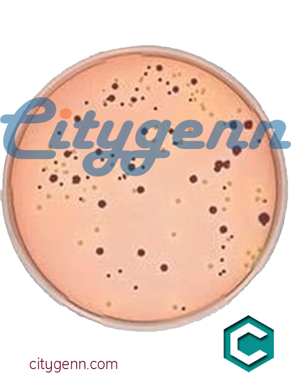 Vogel Johnson Agar Suitable For Microbiology